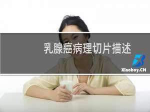 乳腺癌病理切片描述