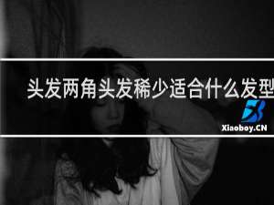 头发两角头发稀少适合什么发型男