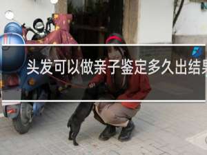 头发可以做亲子鉴定多久出结果