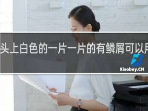 宝宝头上白色的一片一片的有鳞屑可以用身体乳吗