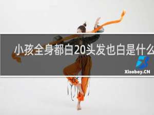 小孩全身都白 头发也白是什么病