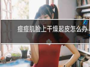 痘痘肌脸上干燥起皮怎么办
