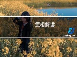 痣相解读（常见30种痣相图解）