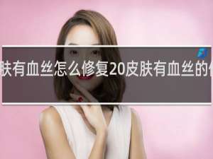 皮肤有血丝怎么修复 皮肤有血丝的修复方法