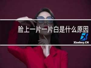 脸上一片一片白是什么原因