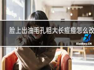 脸上出油毛孔粗大长痘痘怎么改善