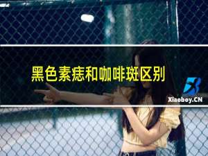 黑色素痣和咖啡斑区别
