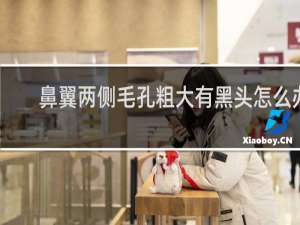 鼻翼两侧毛孔粗大有黑头怎么办
