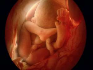 五个月胎儿图