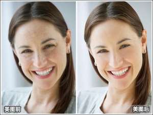 美图秀秀帮你打造均匀嫩滑肤质 完美祛斑