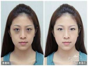 美图秀秀消除黑眼圈 美丽容颜瞬间焕发