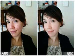 美图秀秀快速祛痘痘 打造光滑肌肤效果