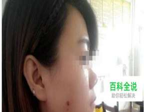 photoshop中如何去掉脸上的斑点？