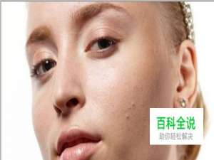 如何使用ps去掉脸上的瑕疵？