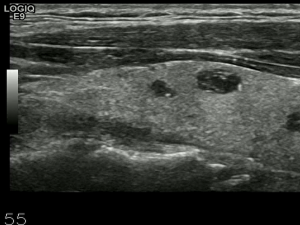 【开发技术】.Net使用FFmpeg视频特定帧上绘制内容_ffmpeg roi