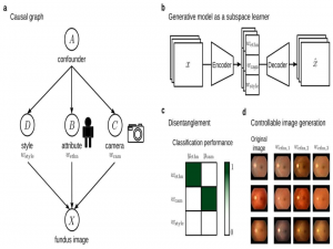 用生成模型解开视网膜图像的表征|文献速递-医学影像算法文献分享