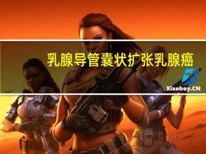 乳腺导管囊状扩张乳腺癌