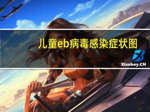 儿童eb病毒感染症状图（儿童eb病毒感染症状）
