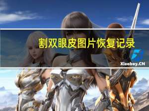 割双眼皮图片恢复记录(双眼皮去皮去脂全切恢复过程)
