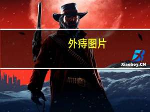 外痔图片（关于外痔图片的介绍）