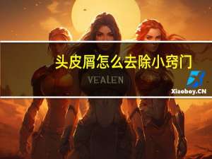 头皮屑怎么去除小窍门（头皮屑怎么去除）