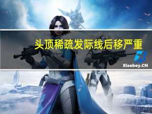 头顶稀疏发际线后移严重（徒弟x师父bl肉）