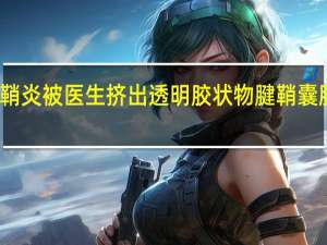 女子腱鞘炎被医生挤出透明胶状物 腱鞘囊肿治疗引热议