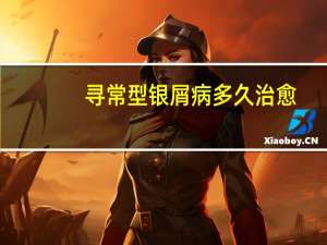 寻常型银屑病多久治愈（寻常型的银屑病几天能够治好）