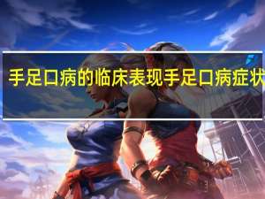 手足口病的临床表现 手足口病症状图片