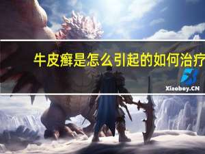 牛皮癣是怎么引起的如何治疗（牛皮癣是怎么引起的）