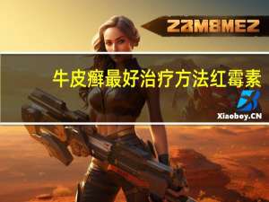牛皮癣最好治疗方法红霉素（牛皮癣最好治疗方法）
