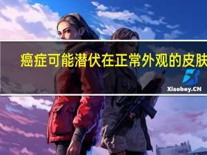 癌症可能潜伏在正常外观的皮肤中
