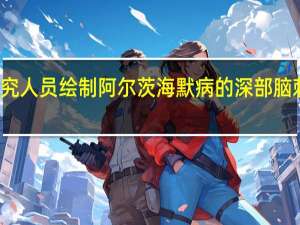 研究人员绘制阿尔茨海默病的深部脑刺激靶点