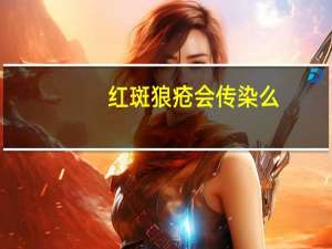 红斑狼疮会传染么（红斑狼疮会传染）