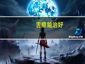 舌癌能治好（舌癌能活多久）