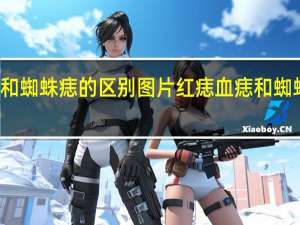 血痣和蜘蛛痣的区别图片红痣 血痣和蜘蛛痣的区别