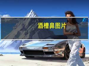 酒槽鼻图片（酒槽鼻怎么办）