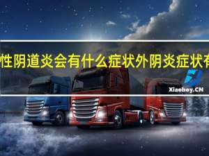 霉菌性阴道炎会有什么症状 外阴炎症状有哪些症状